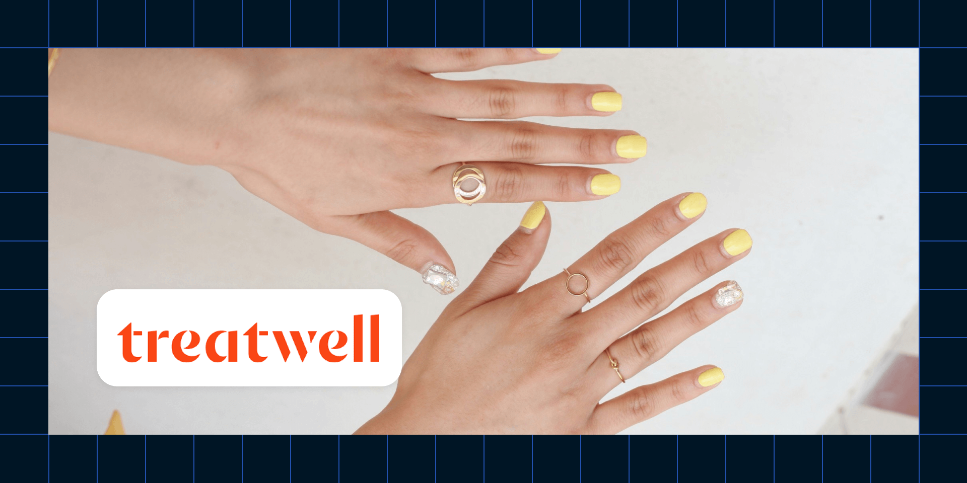Treatwell Automates Financial Processes With Fivetran
